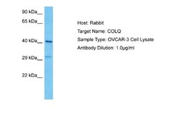 COLQ Rabbit anti-Human, Polyclonal, Novus Biologicals 0.1ml; Unconjugated:Anticorps,